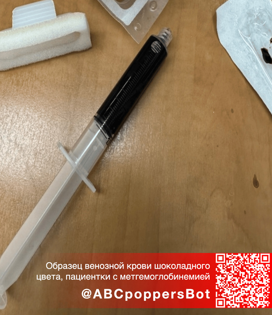 Если принять попперс внутрь в Иванове это вызывает метгемоглобинемию. Смертельное состояние Если принять попперс внутрь в Иванове это вызывает метгемоглобинемию. Смертельное состояние